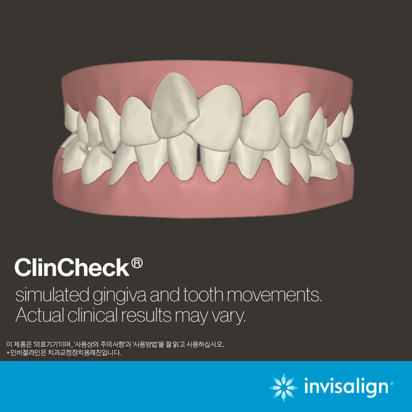 �κ����������۰���